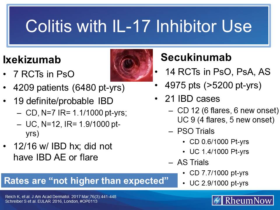 Colitis.IL17.jpg