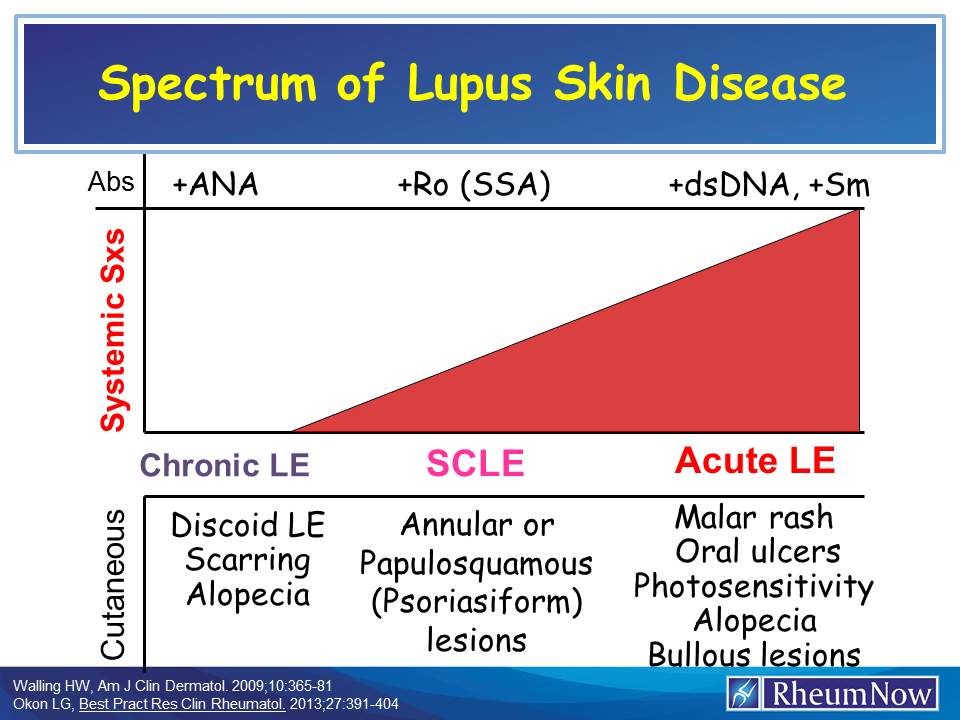 Lupus.spectrum.CLE_.jpg