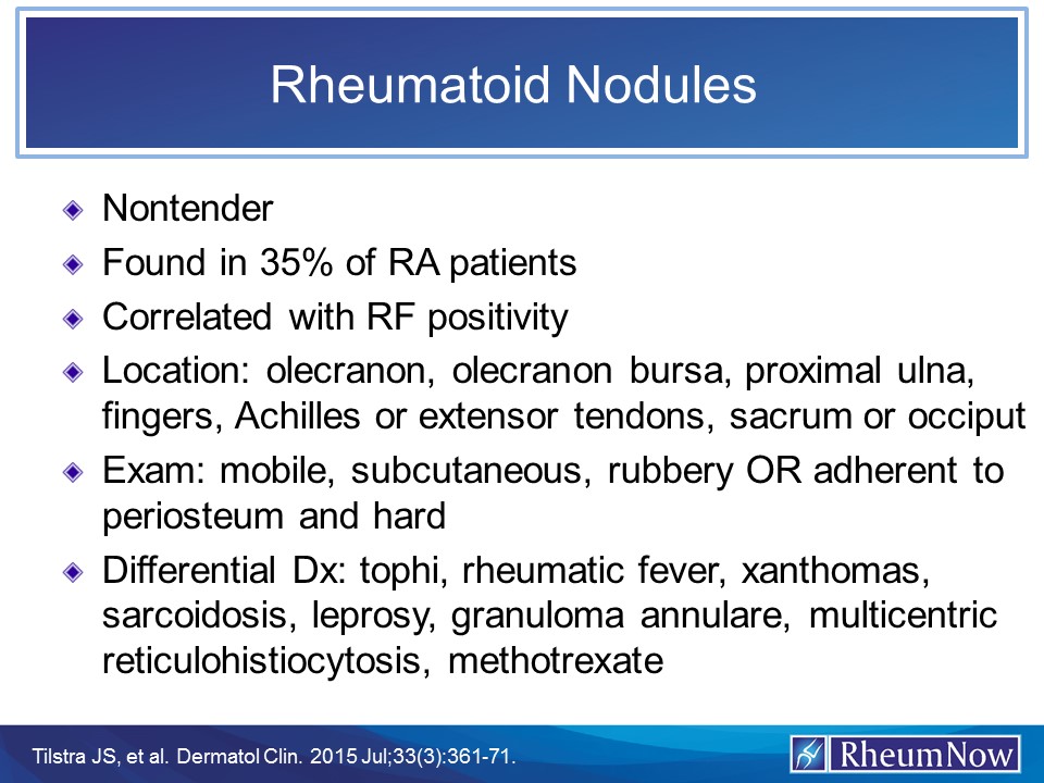 RA.nodules.jpg