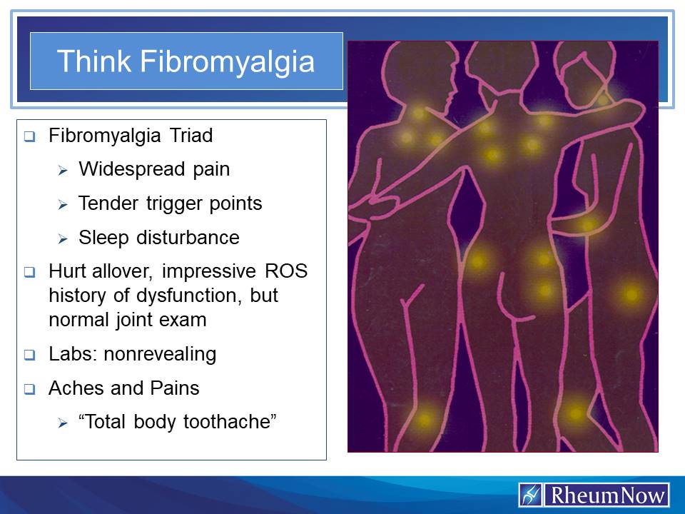 Think%20Fibromyalgia.jpg