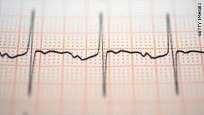 EKG.getty_.jpg (keep)