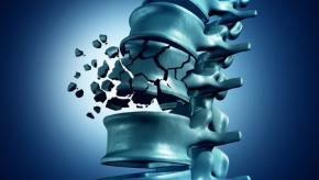 Fracture.spine_.op_.jpg (keep)