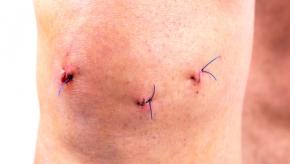 Knee.arthroscopic.jpg
