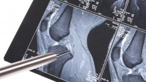 MRI.knee_.jpg