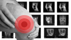 MRI.kneepain.jpg