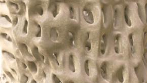 bone%20dense.jpg (keep)