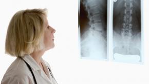 xray%20spine%20films_0.jpg