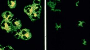 ANCA, vasculitis, test