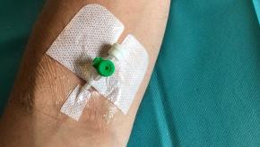 IV,arm,intravenous,infusion