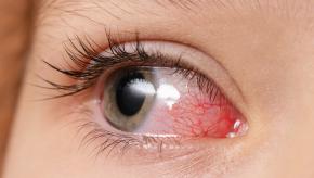 pediatric eye uveitis