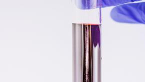 lab.test.genetics.lavender.pcr