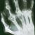 Gout hand