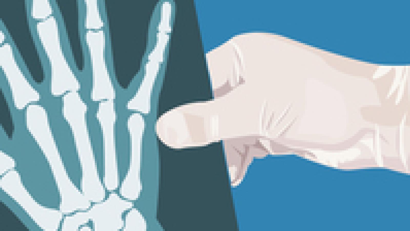 Xray.hand__0.jpg