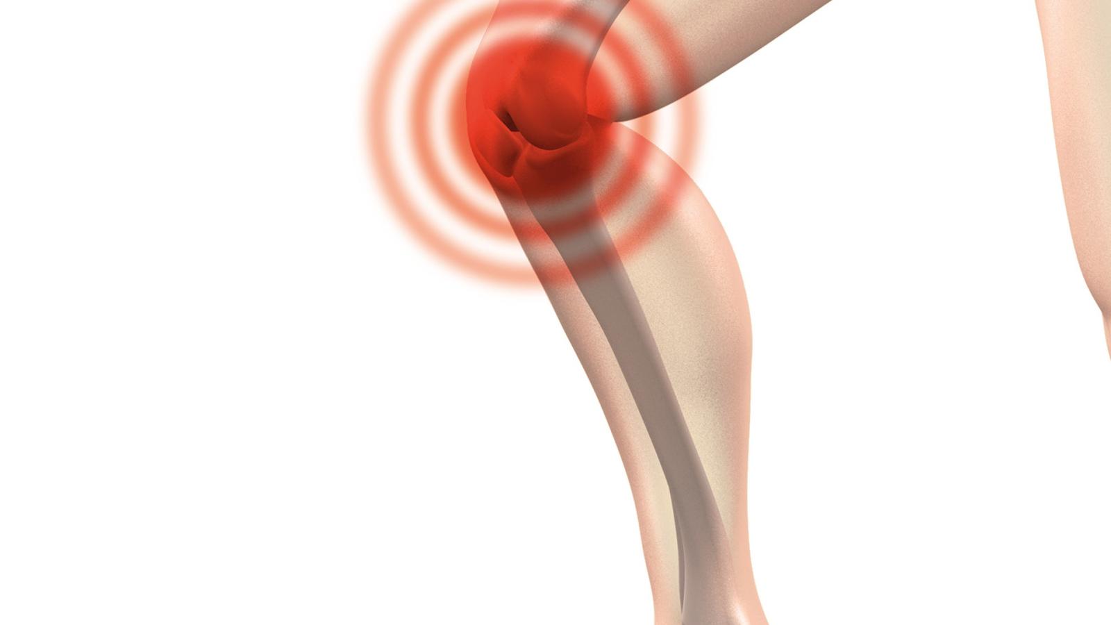 knee,pain3,target