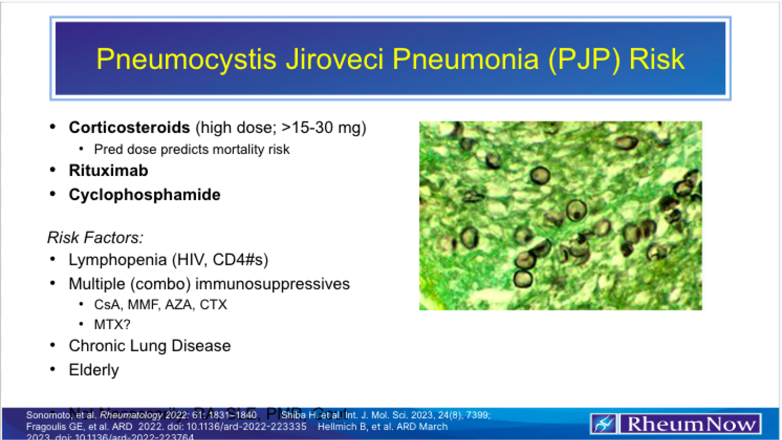 PJP Risk Cover Image